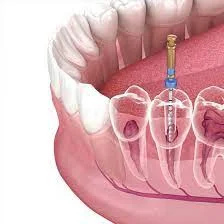 Smile dental Care