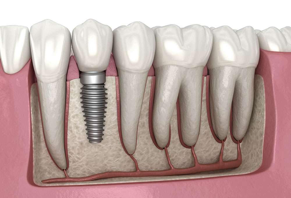 Smile dental Care