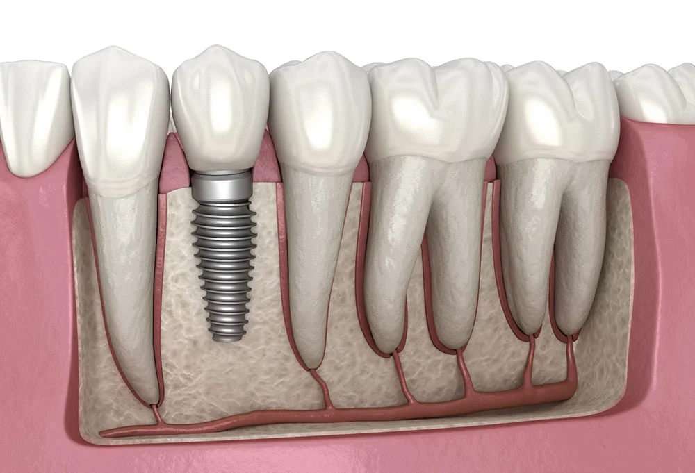 Smile dental Care
