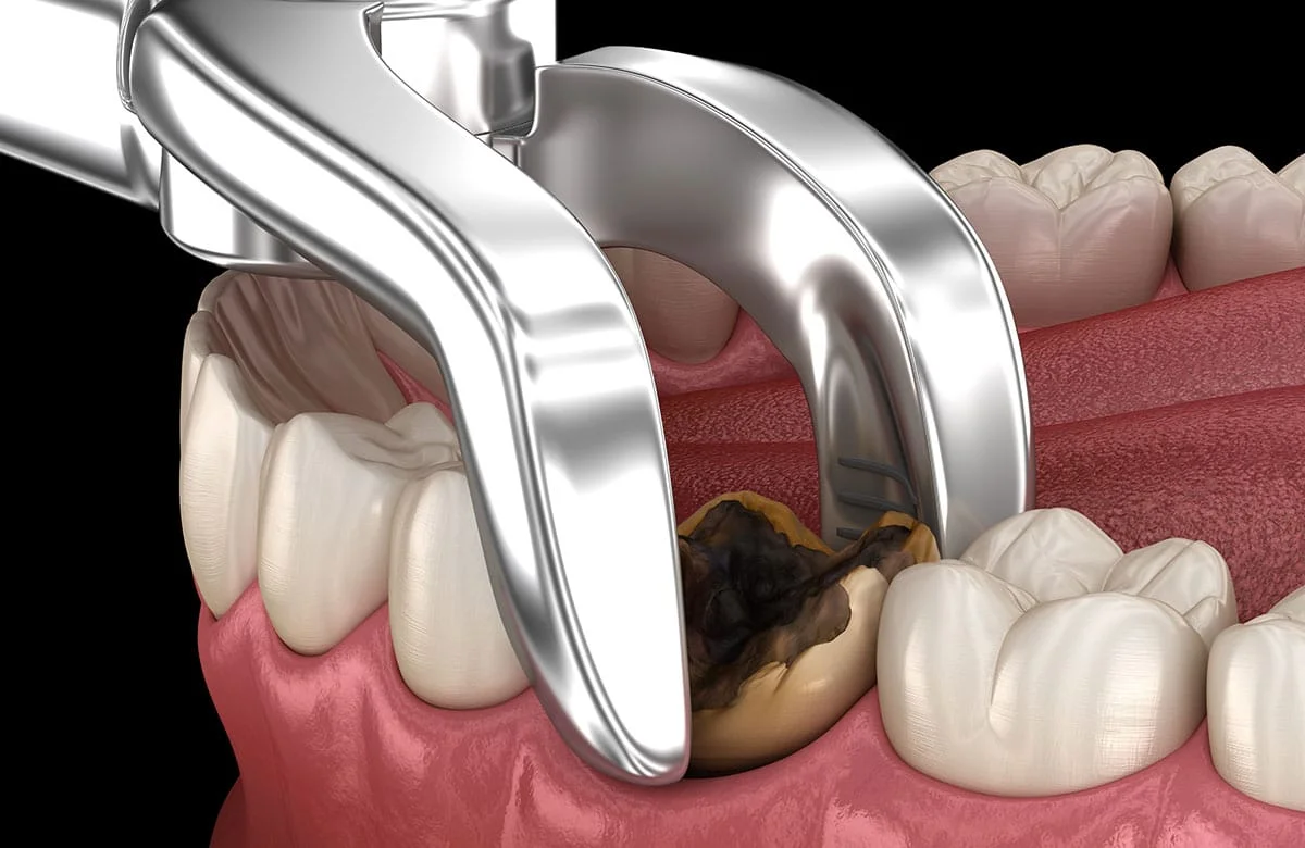 Smile dental Care