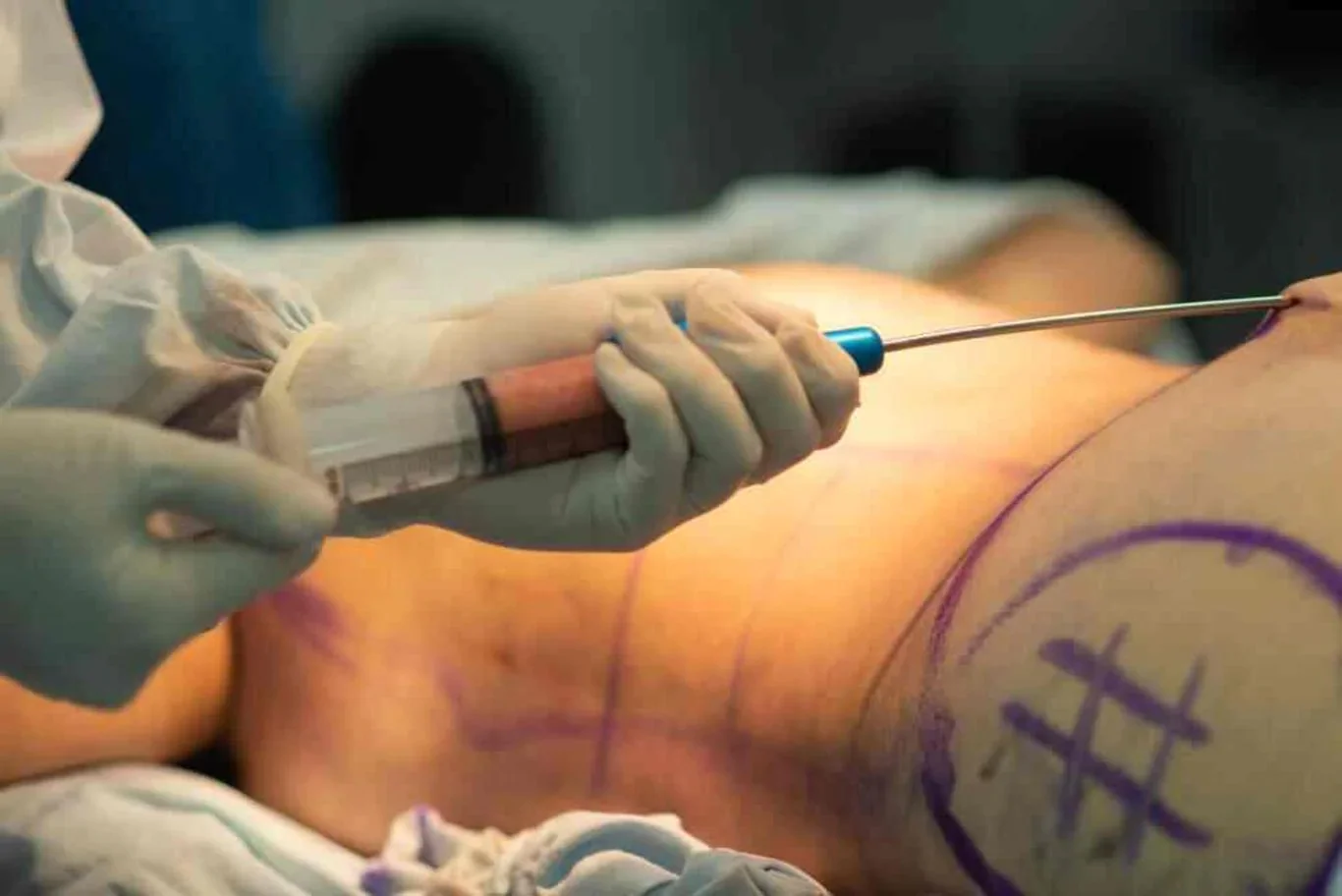 Laparoscopy and General Services